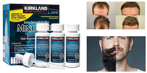 Image of Minoxidil Pro Kirkland